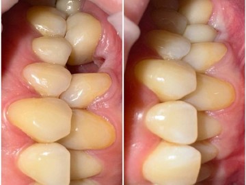 Фотоколлаж (3)