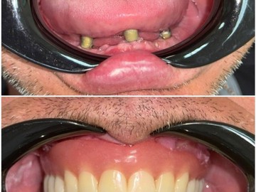 Фотоколлаж (5)