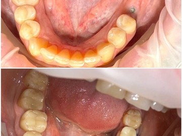 Фотоколлаж (8)