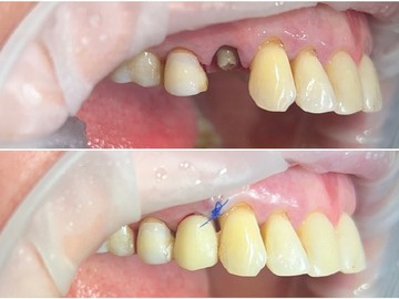 Фотоколлаж