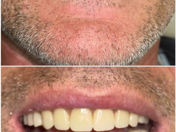 Фотоколлаж (6)